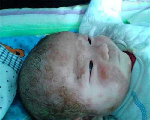 合肥助孕供卵网站官网,合肥试管婴儿费用大概要多少钱？合肥试管助孕试管机